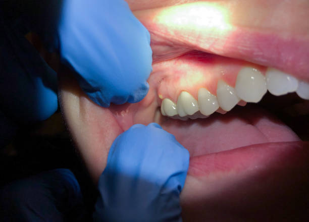Best Walk-In Emergency Dental Services in Santa Moni, CA